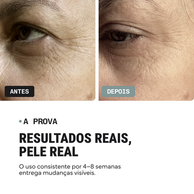 Duo Corretor de Linhas