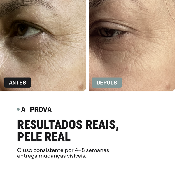 Duo Corretor de Linhas